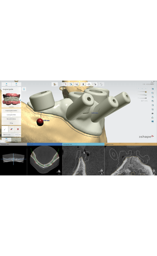 3Shape Implant Studio