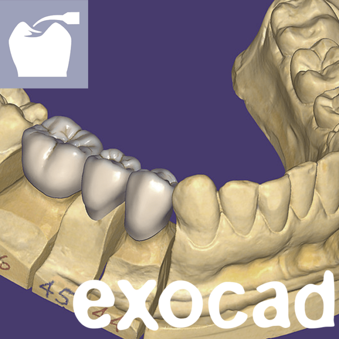 exocad dentalCAD