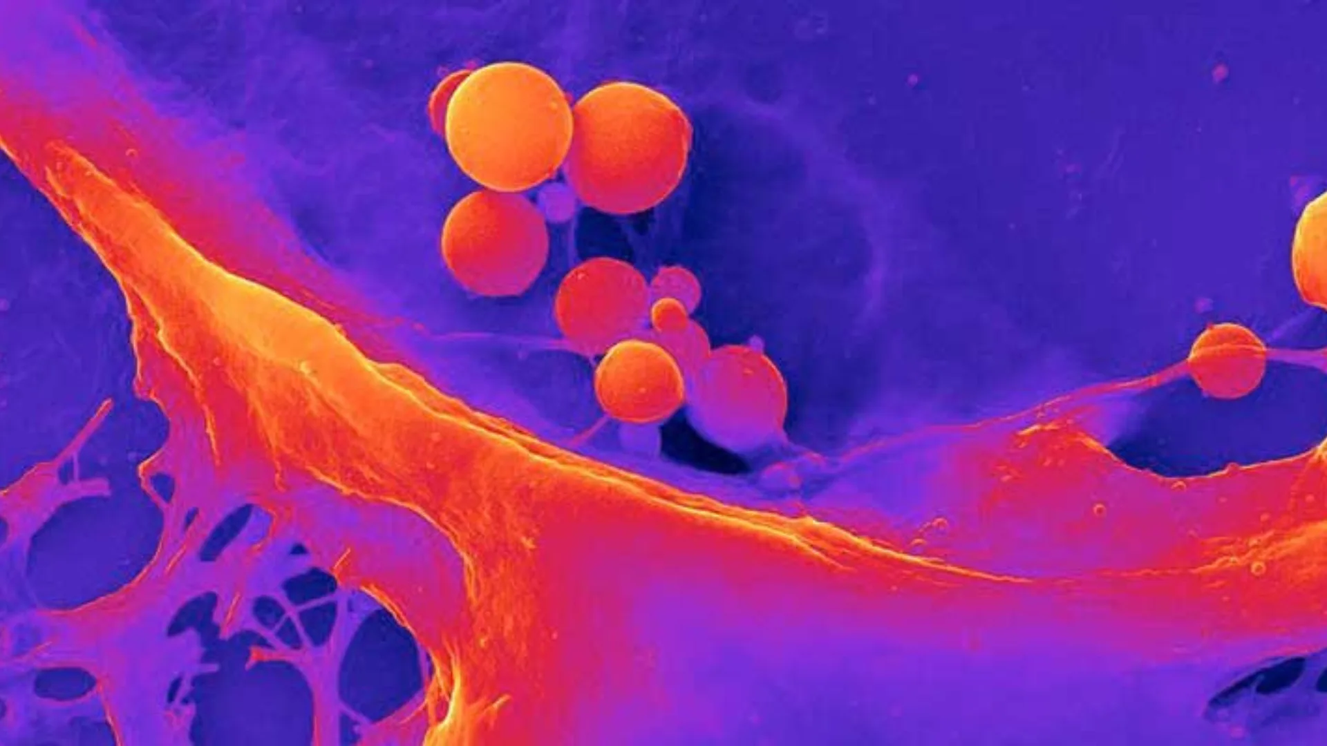 Medicina accelerata con idrogel 3D e il processo di bioprinting