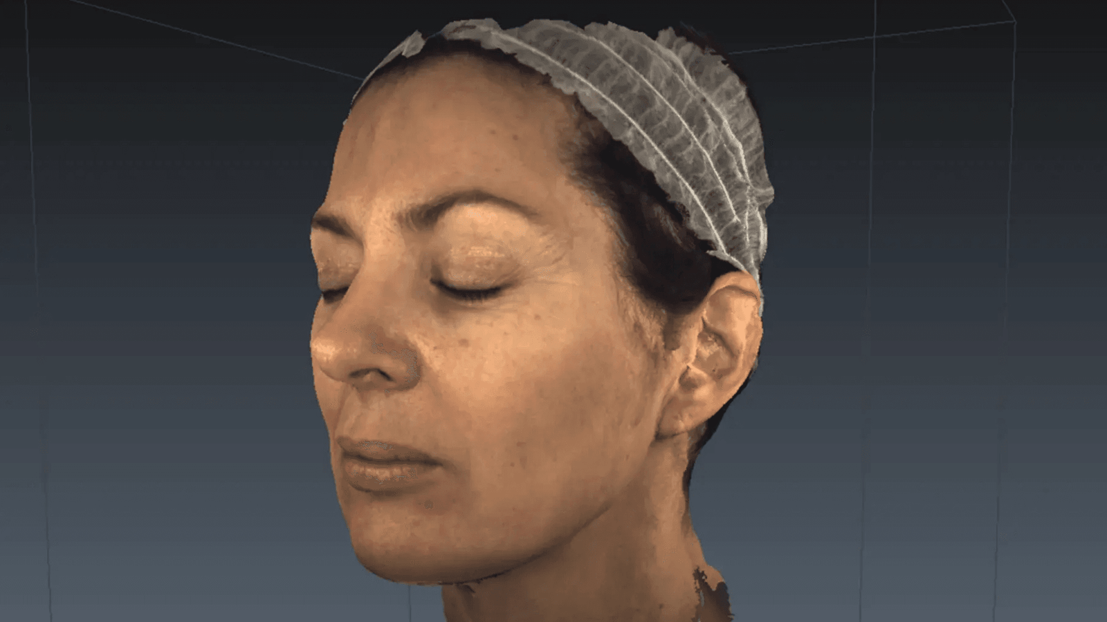 scansione facciale per rughe 3D