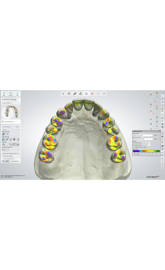 3Shape Dental System