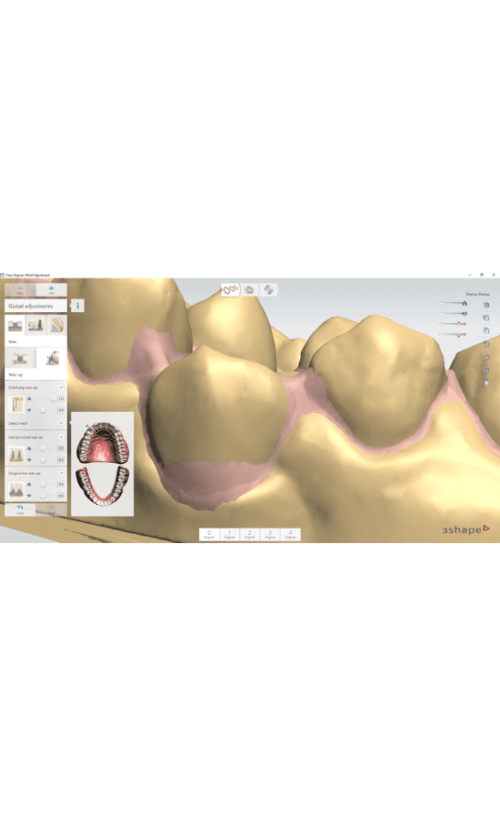 3Shape Ortho System