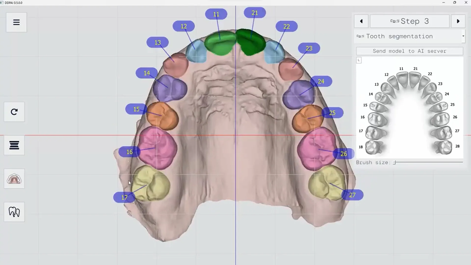 La rivoluzione nella precisione e nell’efficienza dell’ortodonzia